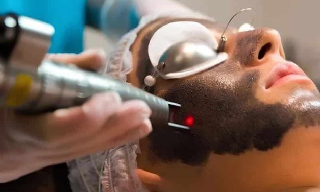 Transformação Instantânea: Os Benefícios do Peeling de Hollywood